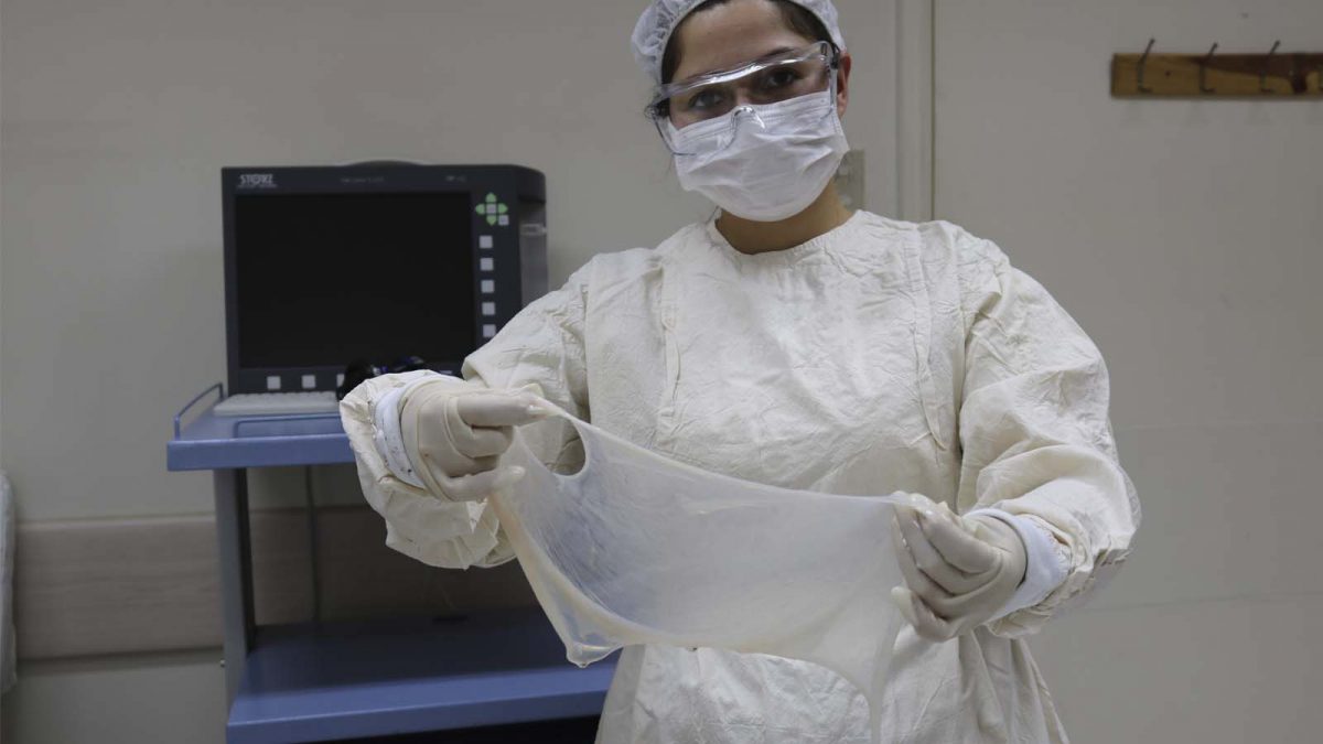 Foto de membrana amniótica mientras es lavada con suero fisiológico.